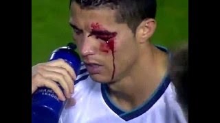 Cristiano Ronaldo  sad moments [upl. by Conal]