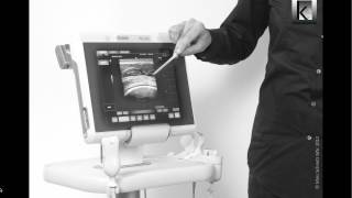 Musculoskeletal ultrasound in physiotherapy part 2 [upl. by Eidassac]