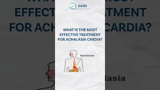 Most Effective Ways to Treat Achalasia Cardia  Dr Aditya dradityakulkarni achalasiacardia [upl. by Gitel13]