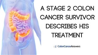 Stage 2 Colon Cancer Survivor Describes His Treatment [upl. by Annette887]