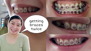 BRACES AGAIN FOR THE SECOND TIME🤔  HOW MUCH BRACES COST IN THE PHILIPPINES 2024 [upl. by Anny991]