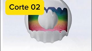 Corte 02 GLOBO DERRETE PARTE 2 [upl. by Romaine139]