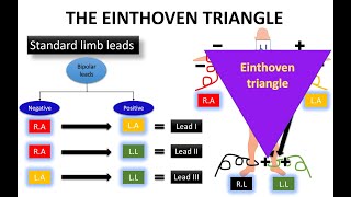 WHAT DO YOU KNOW ABOUT THE EINTHOVENS TRIANGLE ON ECG quotCHEST LEADSquot  NARCOSIS😴🤤 [upl. by Clemen460]