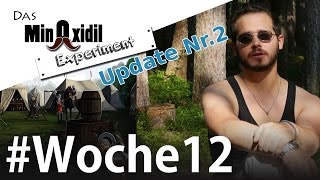 Allergieupdate und Speedpainting Nr2  Das Minoxidil Experiment Woche12 [upl. by Karlie]