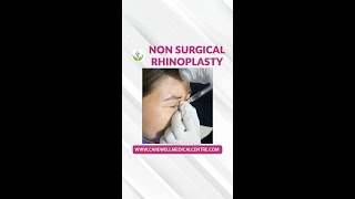 NonSurgical Rhinoplasty How Its Done  Nose Filler How It Works  Nose Job The Process [upl. by Nolahc]