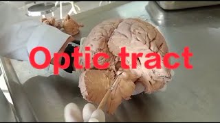 Neuroanatomy Optic pathway anatomy of optic pathway [upl. by Cosetta]