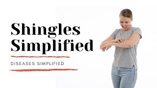 Shingles Simplified [upl. by Aytida]