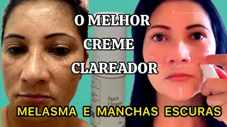 CREME CLAREADOR DE MELASMA E MANCHAS ESCURAS NA PELE  Tratamento NoturnoSilvania Sends [upl. by Crystie733]