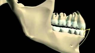 Mandibular Movement 3D [upl. by Ynohtnaed685]