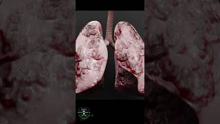 How smokers lungs look biology anatomy 3dmodel [upl. by Stout542]