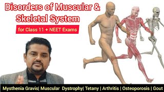 Disorders of Muscular and Skeletal System  Class 11 NCERT NEET Exams  Pashupati Sir [upl. by Barbra]