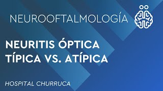 NEURITIS ÓPTICA TÍPICA VS ATÍPICA [upl. by Suolkcin]