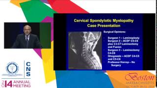 Surgery is Appropriate for Cervical Spondylotic Myelopathy [upl. by Kobi240]