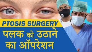 Ptosis Treatment  Droopy Eyelid Treatment  Oculoplastic Surgery for Ptosis at Eye7 Eye Hospitals [upl. by Qerat]