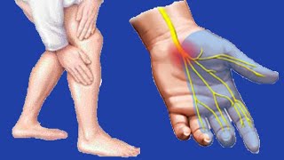 Paresthesia Causes And Symptoms [upl. by Eigla925]