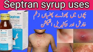 Septran syrup uses in Urduseptran syrupbacterial infection co trimoxazole [upl. by Harrod]