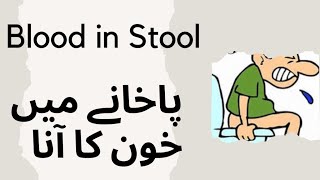 Blood in stool  پاخانے میں خون کا آنا   urdu   Prof Dr Javed Iqbal [upl. by Ahl]