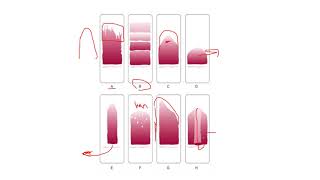 Blood film preparation Staining and Examination part 01 [upl. by Nitreb93]