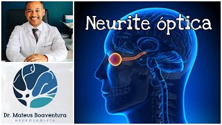 Tudo sobre neurite óptica [upl. by Laurice661]