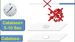 Catalase Coagulase and Oxidase Tests [upl. by Killarney]