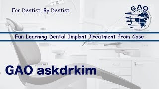 1Dental implant case  A clinical case of implant removal and replacement  GAO askdrkim [upl. by Coonan874]