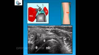 MSK US Lower Limb ANATOMY TECHNIQUE amp COMMON PATHOLOGY 2013 2014 [upl. by Annayrb582]