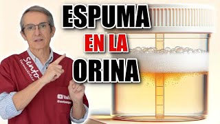 5 MOTIVOS principales de ESPUMA en la ORINA ¡Uno es ENFERMEDAD renal [upl. by Grimaldi305]