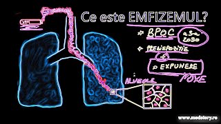 Ce este emfizemul pulmonar Ilustrație [upl. by Awad]