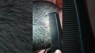 My Boyfriend Let me use a Fine Tooth comb for His Dandruff Scratching Session [upl. by Harias]