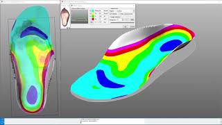 Charcot foot insole designer [upl. by Edsel956]