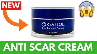 Best Anti Scar Cream 100 WORKS [upl. by Deth]