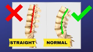 How To Correct Straightening Of Lumbar Spine FIX LOSS OF LUMBAR LORDOSIS  Dr Walter Salubro [upl. by Rosenwald35]