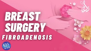 3 Breast Fibroadenosis  التضخم الغدى [upl. by Ion]