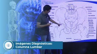 Imágenes Diagnósticas Columna Lumbar [upl. by Nonahs]