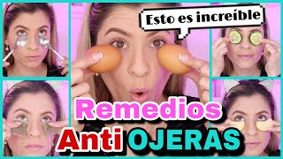 TRUCOS Y REMEDIOS CASEROS PARA ELIMINAR LAS OJERAS  ELIMINAR OJERAS EN CASA  NatyGloss [upl. by Doble]