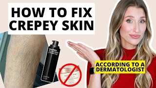 How to Fix Crepey Skin  Dermatologist Explains How to Firm Body Skin [upl. by Nomzzaj26]