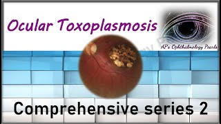 Ocular toxoplasmosis  Comprehensive series 2 [upl. by Swigart]