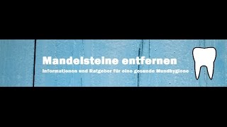 Mandelsteine entfernen  so einfach gehts [upl. by Navar]