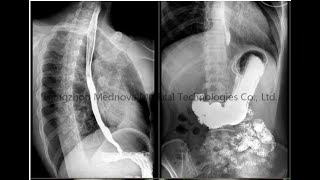 Fluoroscopy image from Digital Fluoroscopy amp Radiography system [upl. by Sweyn]