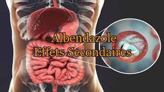 Effets secondaires Albendazole [upl. by Issirk870]