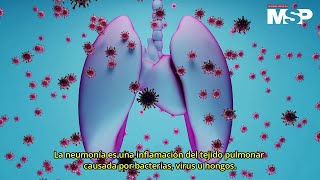 ¿Cómo se da la neumonía en los pulmones  ExclusivoMSP [upl. by Elenaj]