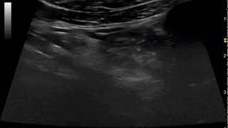 Sonography of the cervical oesophagus in a dog with generalised myositis [upl. by Attelocin]