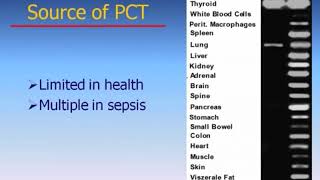 SEPSIS  Advances In The Early Detection and Management of Sepsis  US [upl. by Gora]