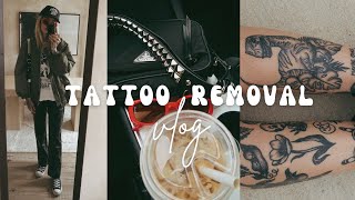 GETTING MY TATTOOS REMOVED  Tattoo Removal Laser Vlog [upl. by Merideth]