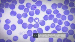 Geimsa Stain  for Plasmodium and Babesia Parasite Diagnostics [upl. by Aidnyc400]