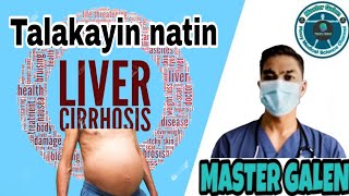 Liver Cirrhosis talakayin natin [upl. by Aia]