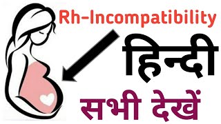 Rh Incompatibility in Pregnancy  complication in pregnancy in hindi [upl. by Guillemette664]