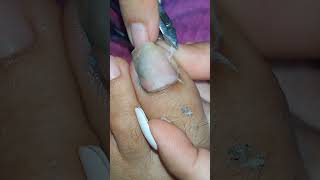 cleaning Toenail [upl. by Artined58]