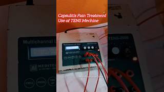 Capsulitis Pain Treatment Use of TENS Mechine physiotherapy forzensoulder viralvideo shorts [upl. by Maribel]