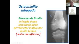 Infecções Osteoarticulares [upl. by Azelea]